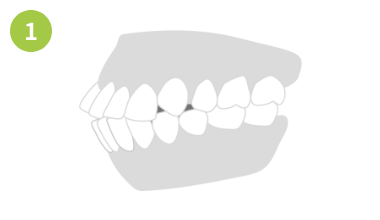 口元がでている場合画像1