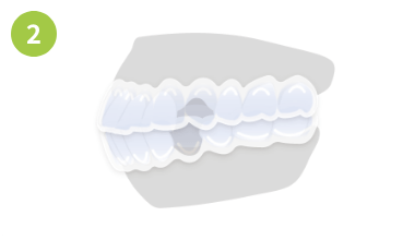 口元がでている場合画像2